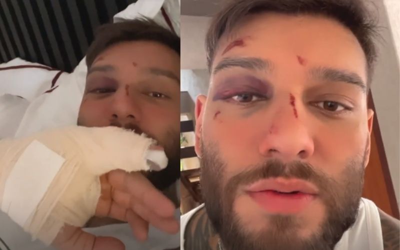 Lucas Lucco desmaia em casa e fratura um dedo após exagerar na bebida
