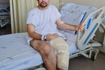 “Pensando na minha qualidade de vida, decidi amputar”, diz o itabirano Cadu