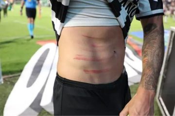 Lateral atleticano mostra marcas depois de falta violenta contra o Goiás