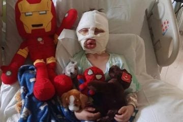Bullying: garoto de 6 anos é atingido por bola de tênis em chamas
