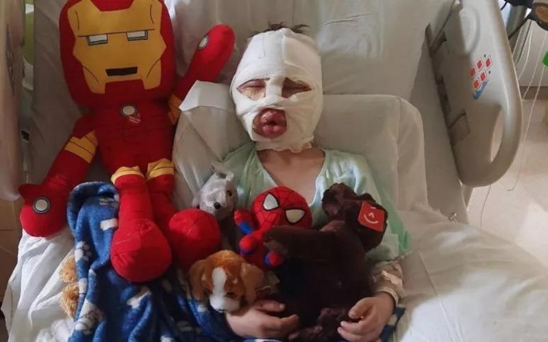 Bullying: garoto de 6 anos é atingido por bola de tênis em chamas