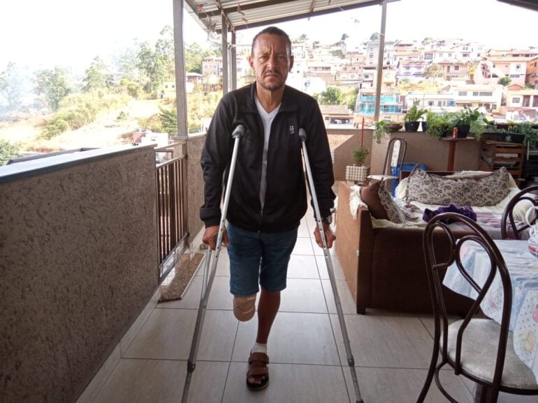 “Sensação é que não servimos para mais nada”. Itabirano pede ajuda na busca por uma prótese