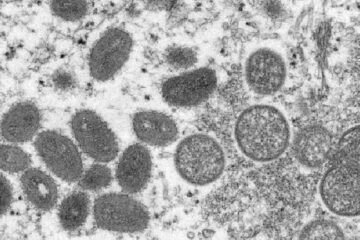 Varíola dos macacos: suspeita de primeira morte pela doença está sendo investigada em Minas
