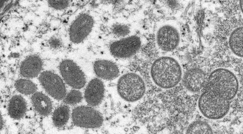 OMS reconhece varíola dos macacos como emergência de saúde global