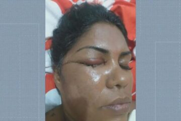 Mulher golpeada com facão por escutar o samba sobre Exu