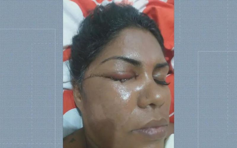 Mulher golpeada com facão por escutar o samba sobre Exu
