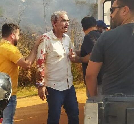 Helicóptero com deputado Hercílio Diniz cai em campo de futebol