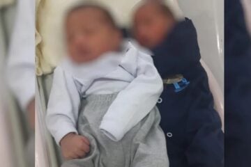 Médico relata caso de gêmeos de pais diferentes em Goiás; entenda