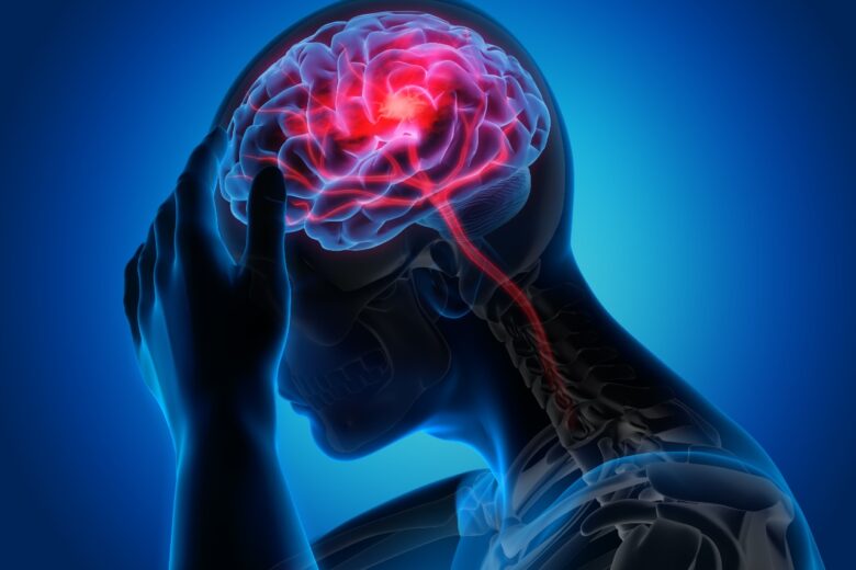 Cresce número de brasileiros mortos por acidente vascular cerebral