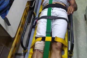 Buraco provoca acidente com motociclista no Bethânia