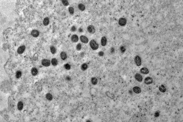Mpox ainda é problema de saúde pública, dizem especialistas na Fiocruz