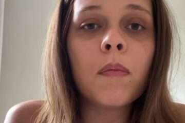 Estudante de medicina tem braço amputado e faz vaquinha para comprar prótese biônica para exercer a profissão
