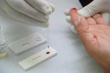 Dezembro Vermelho: Itabira tem teste e tratamento gratuito para HIV