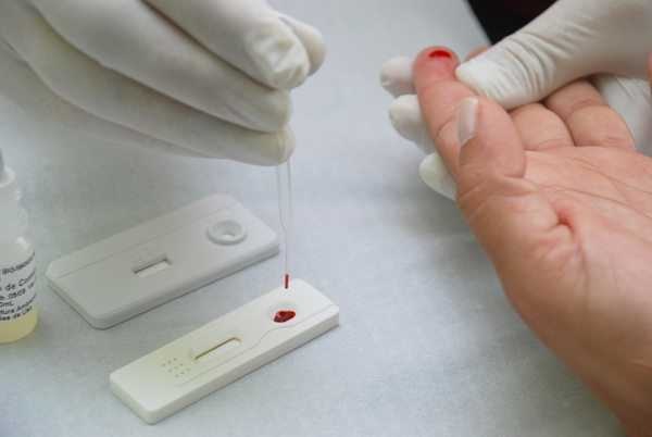 Dezembro Vermelho: Itabira tem teste e tratamento gratuito para HIV