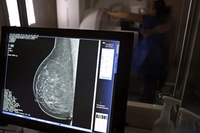 Cerca de 77 mil mulheres aguardam mamografia pelo SUS