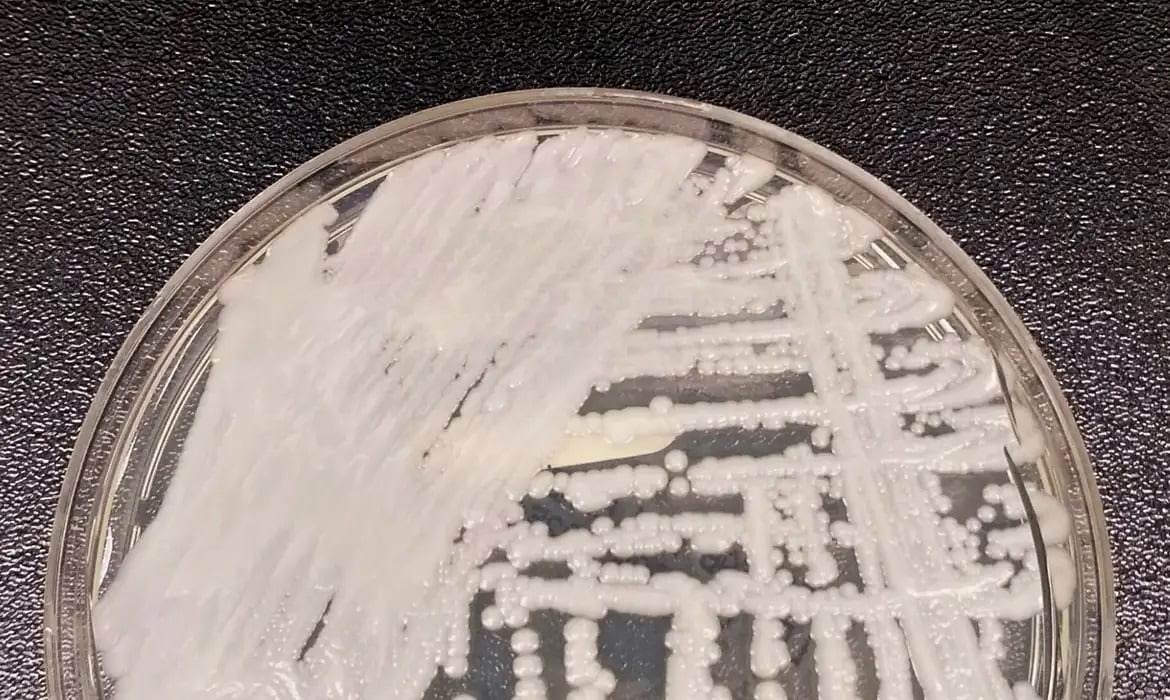Superfungo Candida auris: Belo Horizonte tem quatro casos confirmados e um paciente morreu