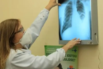 Brasil corre risco de aumento da tuberculose e não deve cumprir meta da OMS