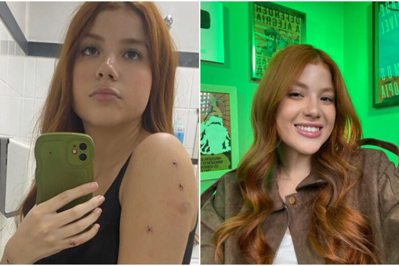 Influenciadora Laura Sabino sofre tentativa de feminicídio do irmão em BH mesmo com medida protetiva