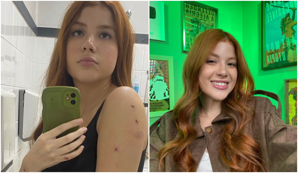 Influenciadora Laura Sabino sofre tentativa de feminicídio do irmão em BH mesmo com medida protetiva