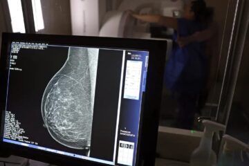 Câncer de mama: uma em cada três pacientes tem menos de 50 anos