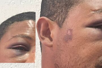 “Eu vou matar você hoje”: homem agredido por policial militar em Itabira relata sequência de ameaças, tortura e medo