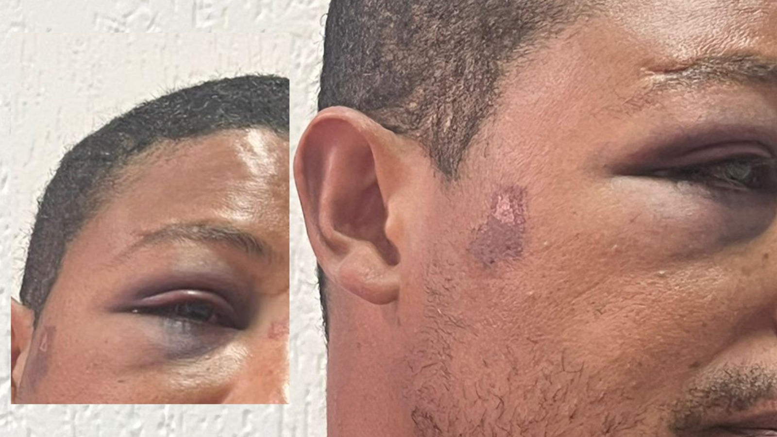 “Eu vou matar você hoje”: homem agredido por policial militar em Itabira relata sequência de ameaças, tortura e medo