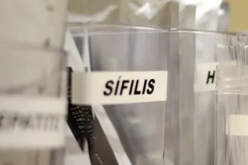 Sífilis continua em ritmo acelerado de crescimento no país
