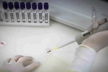 Paciente em SP com suspeita de ebola testa positivo para meningite