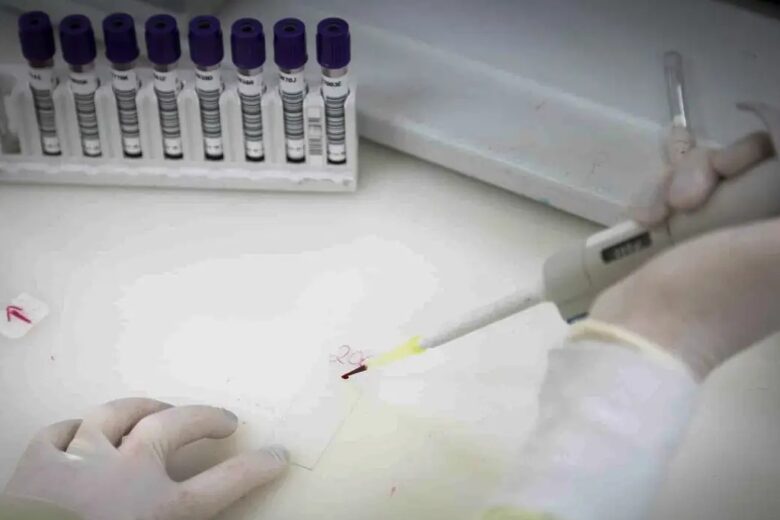 Paciente em SP com suspeita de ebola testa positivo para meningite