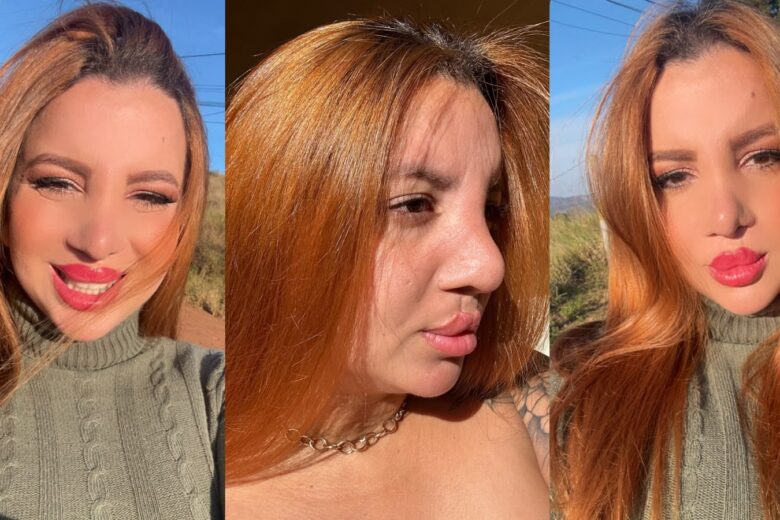 Larissa Rocha relata enfrentamento ao preconceito e inspira pacientes com fissura labiopalatina
