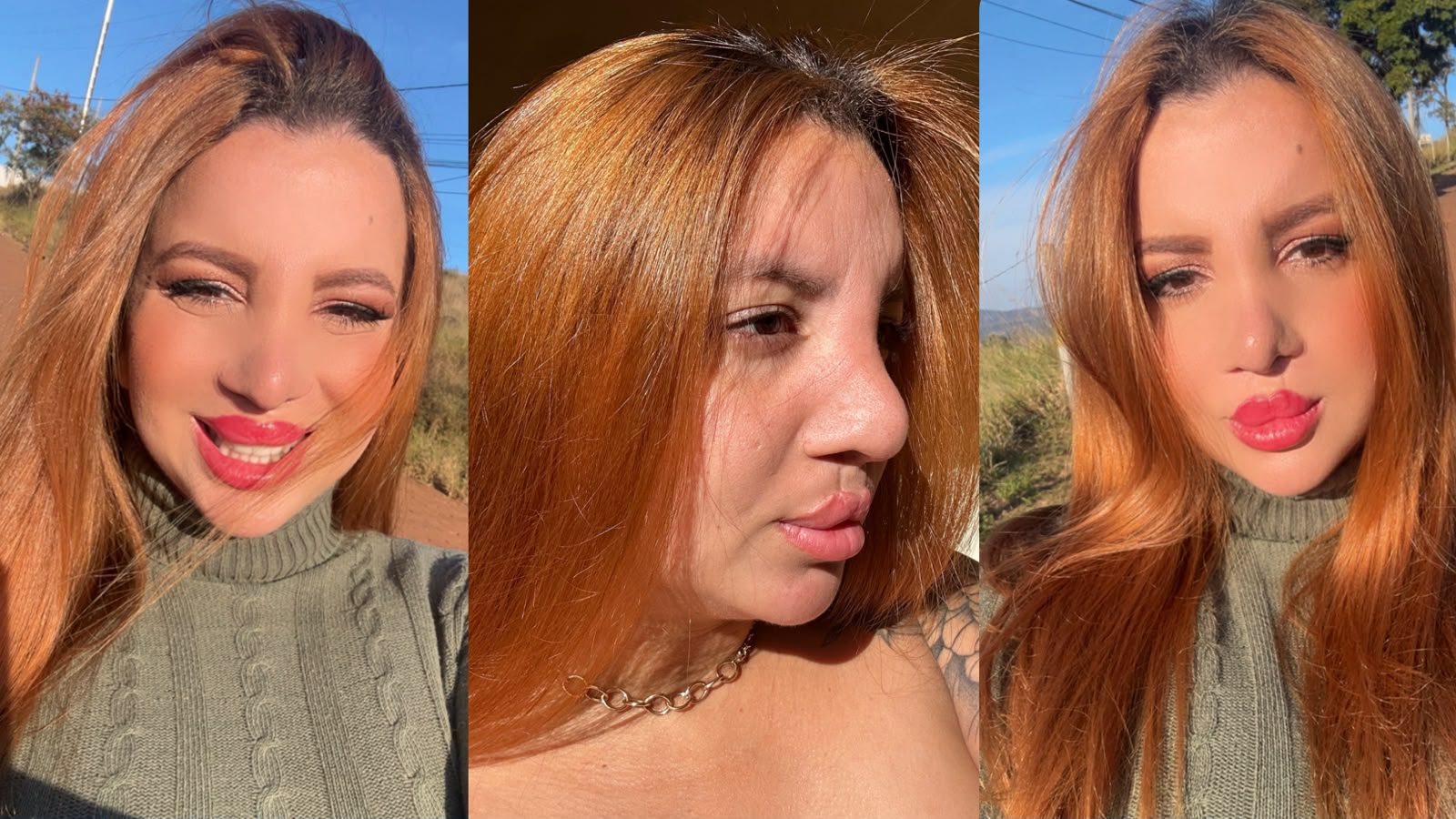 Larissa Rocha relata enfrentamento ao preconceito e inspira pacientes com fissura labiopalatina